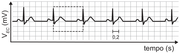 Gráfico de eletrocardiograma. O eixo horizontal mede o tempo, em segundos; o vertical, a intensidade do sinal V subscrito E C, em milivolts. O traçado apresenta seis picos altos e estreitos, regularmente espaçados, com pequenas ondas entre eles. Duas linhas tracejadas passam por picos consecutivos, separados por cinco quadrículas horizontais. Uma quadrícula horizontal corresponde a 0,2 segundo.