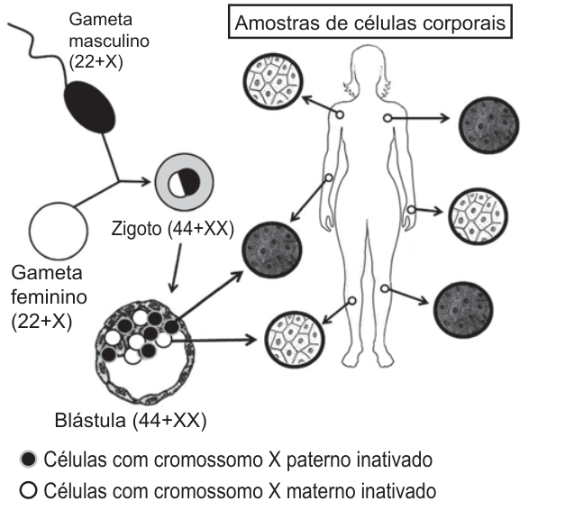Esquema: gameta masculino (22+X) e feminino (22+X) formam um zigoto (44+XX), que se desenvolve em blástula (44+XX). A blástula contém células claras e escuras. Setas levam a amostras de células de diferentes regiões do corpo de uma mulher; algumas amostras são claras, outras escuras. Na legenda, células escuras têm o cromossomo X paterno inativado; células claras, o X materno inativado.